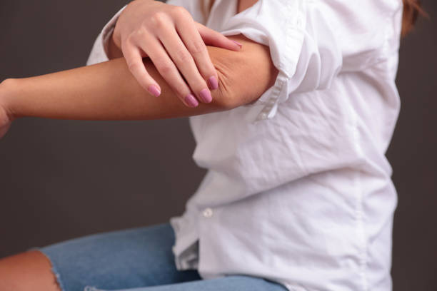 istock Woman touching painful elbow close up. Computer Elbow,Pain From Typing 1464233884