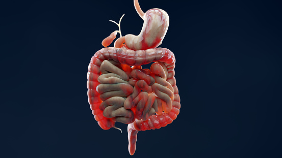 Hombre que sufre de enfermedad de Crohn, anatomía masculina, intestino grueso inflamado, colon sigmoide, partes del sistema digestivo humano, renderizado 3D photo