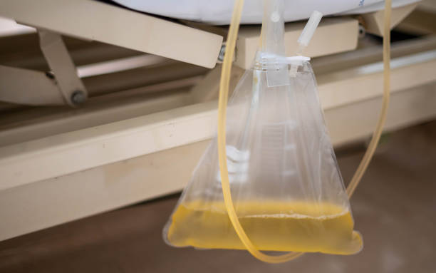 The urine or pee catheter bag hang under patient bed in hospital. stock photo