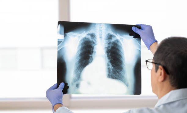 istock doctor analysing an x ray 1464605348