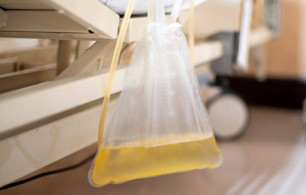 The urine or pee catheter bag hang under patient bed in hospital. stock photo