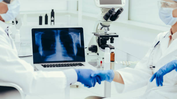 x-ray of the lungs on a laptop screen in the lab stock photo