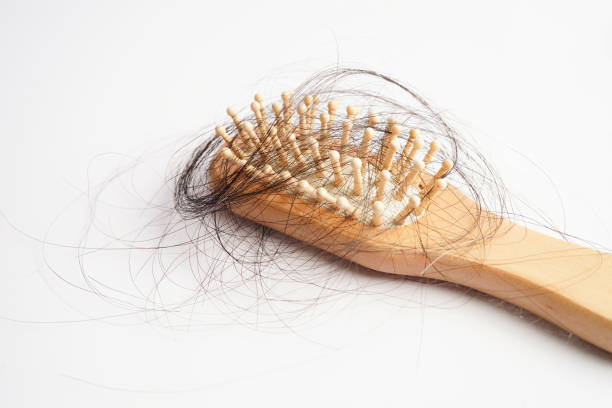 istock Hair loss fall with comb brush isolated on white background. 1464876190