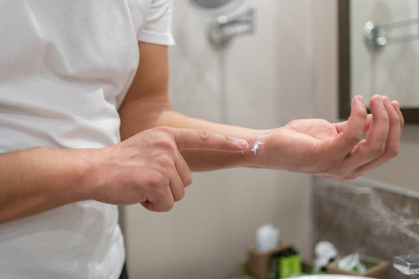 лечение раздражений кожи - dermatitis dry human hand human skin стоковые фото и изображения