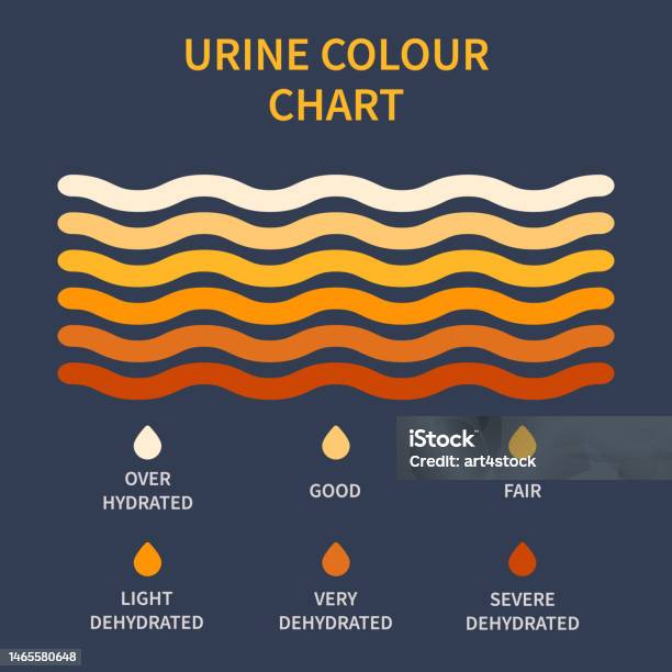 Urine Color Chart Illustration Of Dehydration Level Stock Illustration