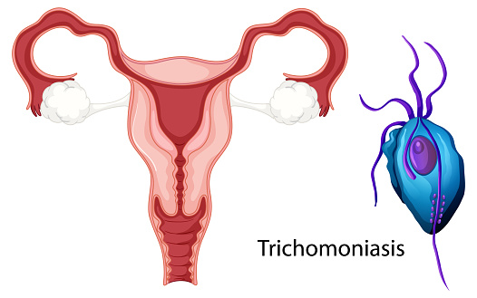 Vaginal infection bacteria concept illustration