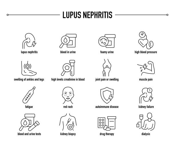 Lupus Nephritis vector icon set. Line editable medical icons. Lupus Nephritis symptoms, diagnostic and treatment vector icons kidney failure stock illustrations