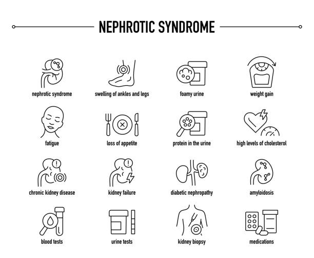 набор векторных значков нефротического синдрома. строка редактируемых медицинских иконок. - glomerulus stock illustrations