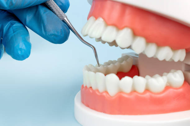 istock Dentures Dental Teeth Model with dentist tool. Complete denture or full denture on blue background. 1466073624