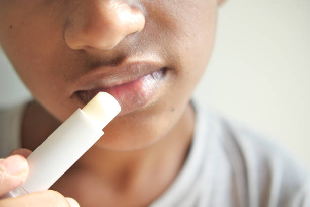 istock young man applying moisturising lip balm on lips 1466225918