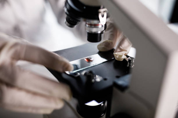 Scientist analyzing red liquid or blood under a microscope stock photo