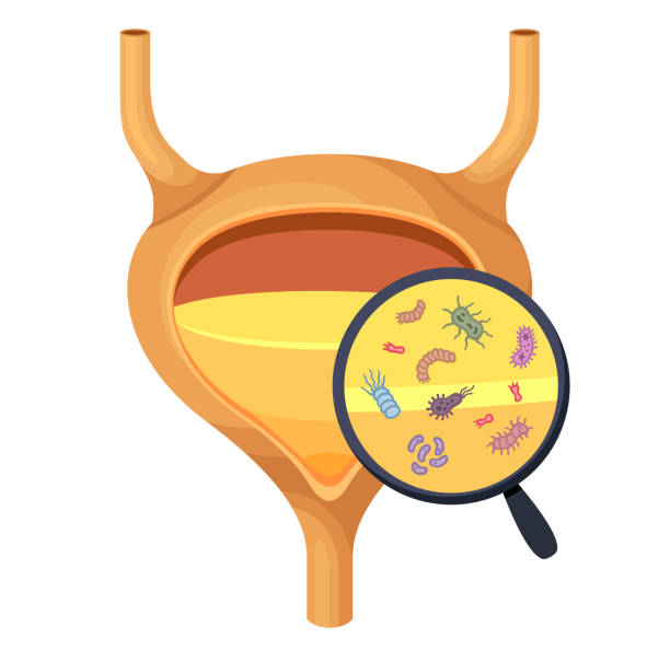kandung kemih dengan urin. infeksi dan radang urin. virus dan bakteri. infeksi bakteri. - kandung-kemih ilustrasi stok