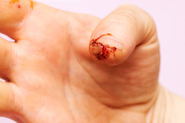 手指の身体的損傷。男性の指に血がついた新鮮な傷 - wound blood human finger physical injury ストックフォトと画像