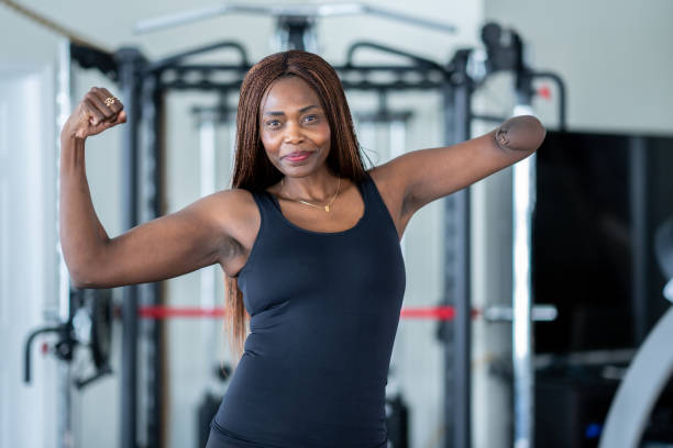 istock Portrait of a Female Amputee 1466471729