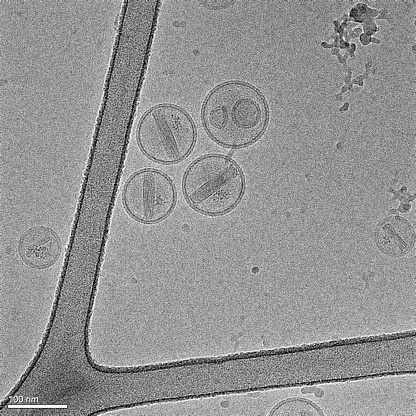 Several nanoparticles made of lipids containing an anticancer drug. The drug appears as a crystal inside of the spherical liposomes