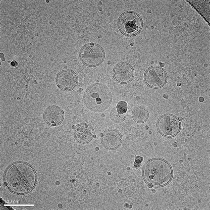 A micrograph of nanoparticles made of lipids containing an anticancer drug. The drug appears as a crystal inside of the spherical liposomes