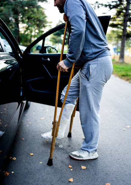 istock A young man with a broken leg is trying to use a car. 1466776642