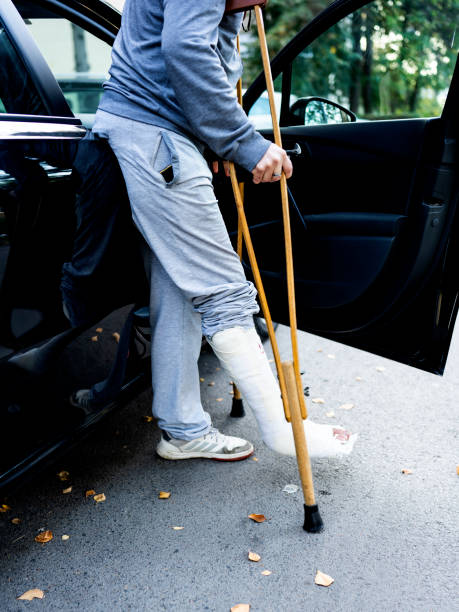 istock A young man with a broken leg is trying to use a car. 1466776685