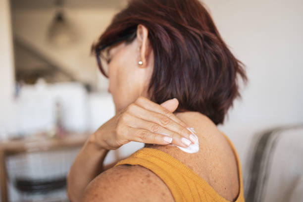 A senior Latin woman is sitting on her living room sofa and applying a hormone cream to her shoulder. stock photo
