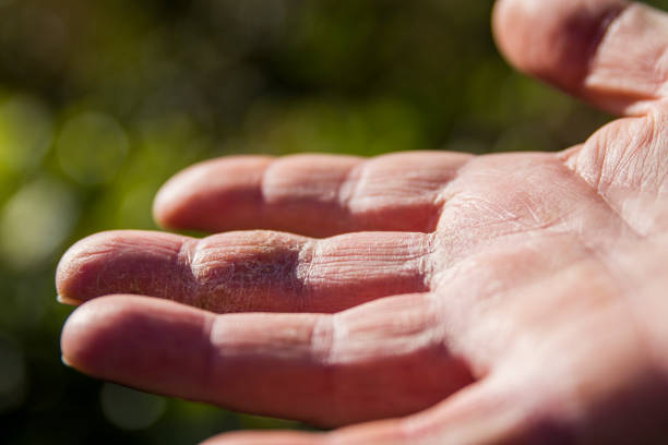 istock Dry Hand Skin With Health Problems 1466789930