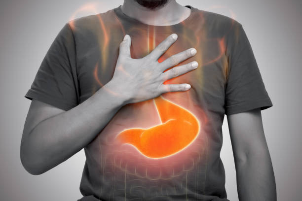 acid reflux or heartburn - indigestie fotos stockfoto's en -beelden