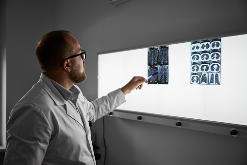 Side view of doctor studying MRI results. Male specialist working in clinic, carrying out description of the radiographs of a patient, pointing by pen. Concept of medicine and healthcare.