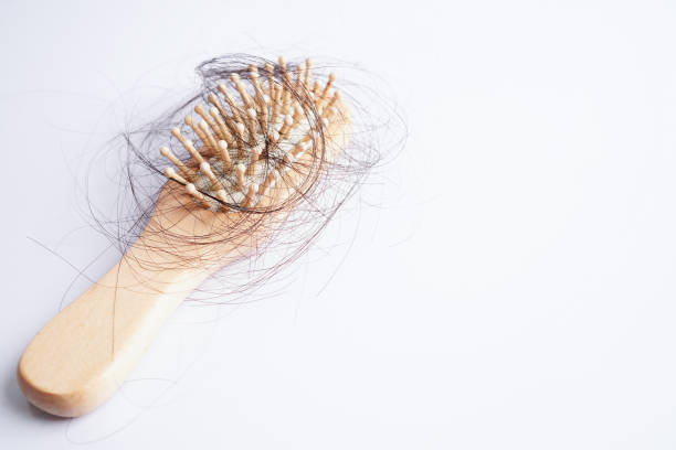istock Hair loss fall with comb brush isolated on white background. 1467321950