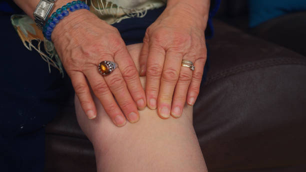 膝の上でピアンを感じる老婆 - arthritis senior adult rheumatoid arthritis sadness ストック��フォトと画像