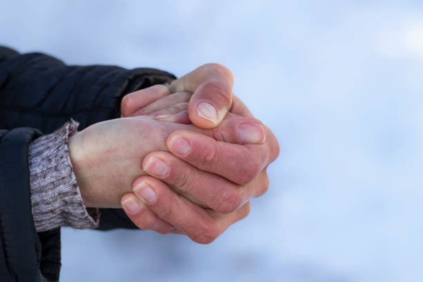 red hands in the cold.risk of frostbite of hand or fingers outdoors during cold weather because of frost in winter. - congelação imagens e fotografias de stock