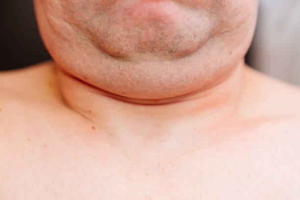 close-up. a man with a pursed chin, second chin. skin after shaving. the problem of excess weight