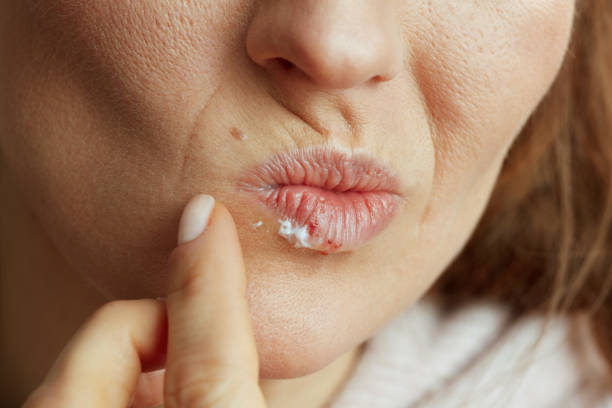 istock Woman applying ointment using finger isolated on beige 1467845333