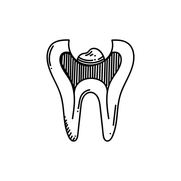 Vector illustration of Tooth Enamel Treatment Tre Line icon, Sketch Design, Pixel perfect, Editable stroke.