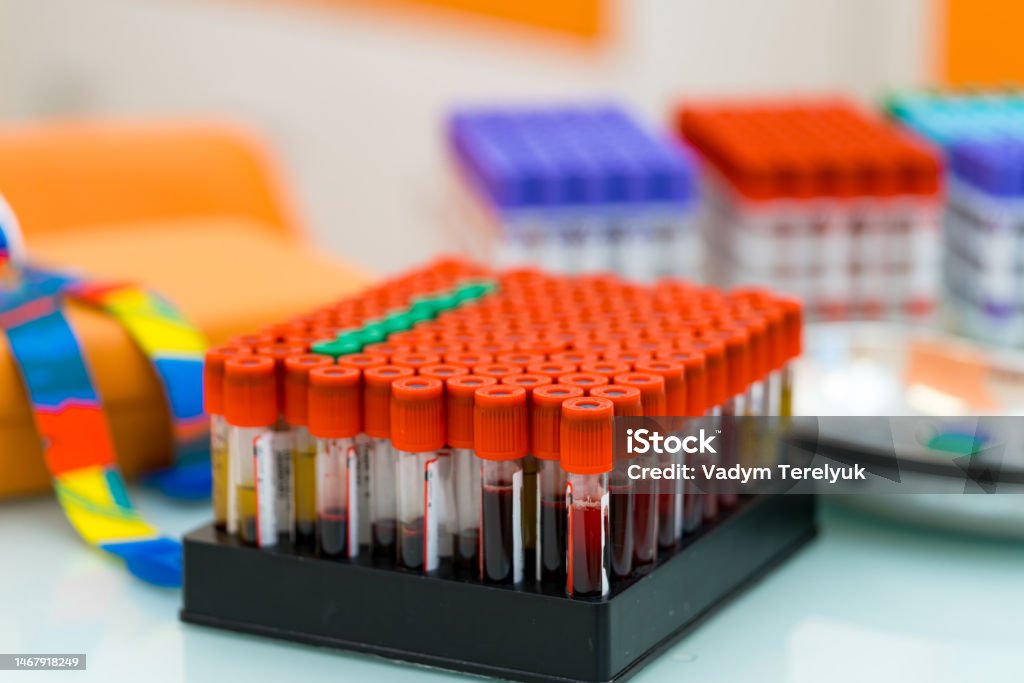 Sample Collection Lab Photo Blood Collecting With Modern Laboratory Tubes Researching Scientific ...