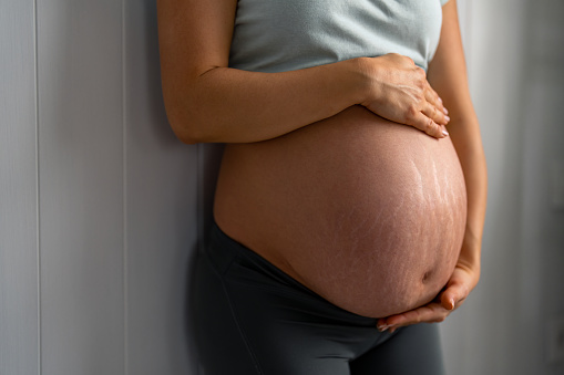 Mujer embarazada irreconocible con estrías sosteniendo sus manos sobre el estómago photo