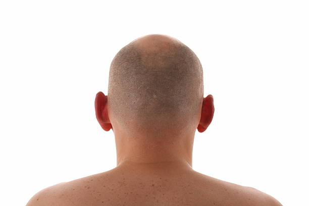 istock man naked back and bald head 146799315
