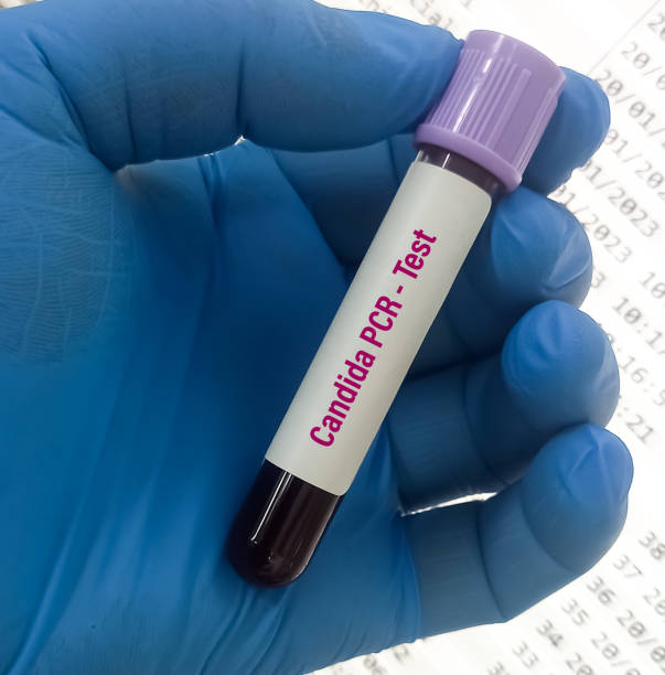 próbka krwi do testu pcr candida do rozpoznania kandydozy. - blood sample blood tube pathologist zdjęcia i obrazy z banku zdjęć