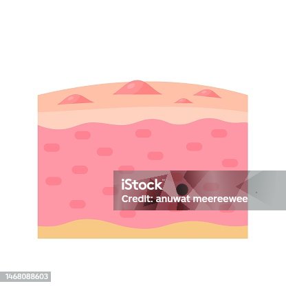 istock human skin layer Caring for protecting the skin from the sun with a skin serum. 1468088603