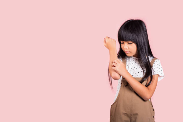 Asian little kid 10 years old scratching itch arm from a mosquito bite