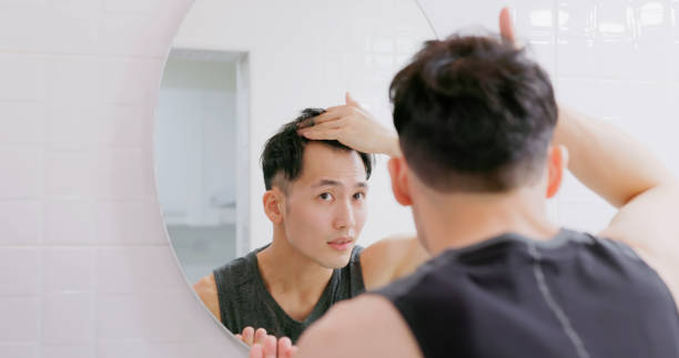 istock man worry about hair loss 1468441647