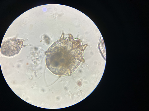 Notoedres cati bajo el microscopio. Sarna notoédrica, también conocida como sarna felina. photo