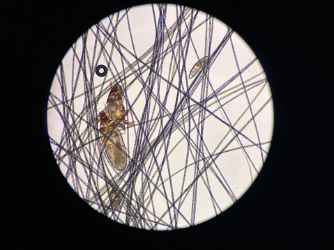 Light Microscope Mite Furmites Under The Microscope Lynxacarus Radovskyi Are Mites Commonly ...