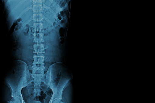 Matured Asian orthopedic medical doctor examining X-ray film on white background