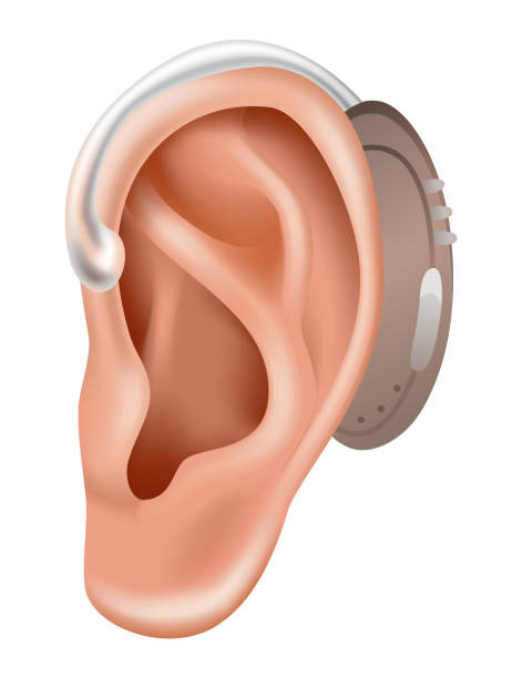 補聴器。難聴患者のためのサウンドアンプ。医学と健康。耳の後ろのリアルなオブジェクト。耳鼻咽喉科における治療と補綴物 - hearing aid点のイラスト素材／クリップアート素材／マンガ素材／アイコン素材
