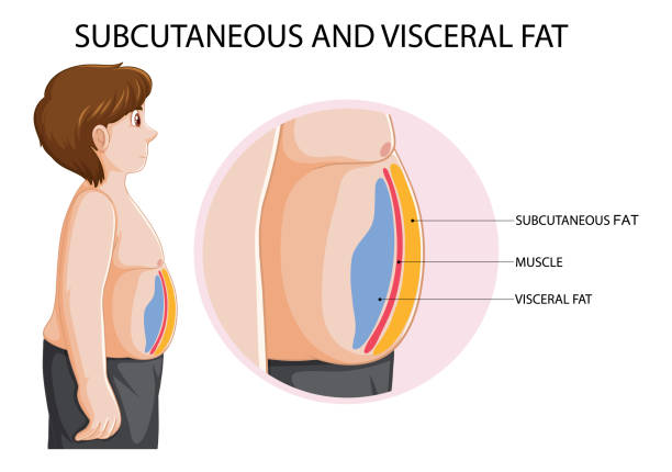 obese patients