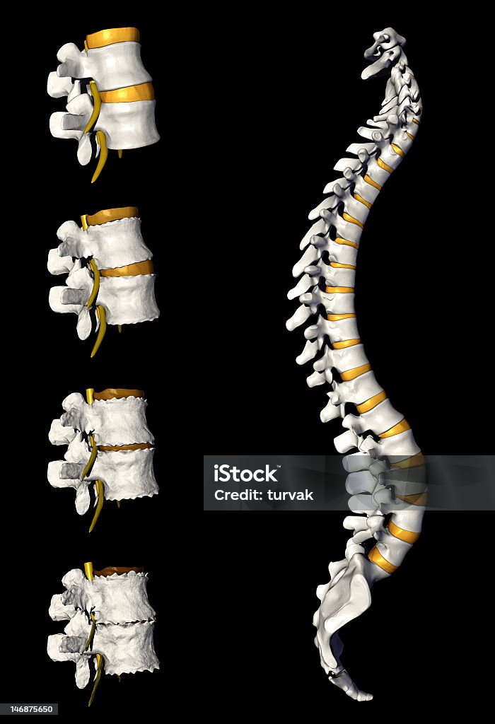 Coluna vertebral com degeneração - Royalty-free Declínio Foto de stock