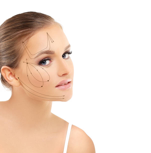 istock thread lift procedure ,non-surgical facelift,markup 1468792779