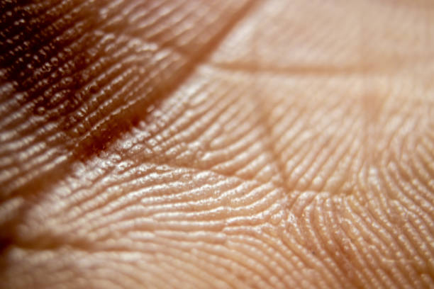 istock Human skin, dermatilis. Dermatology surface orange pattern. Natural skin texture. 1468918924