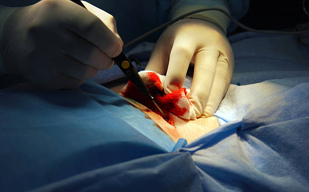 Surgery. Cancer ill women operation stock photo