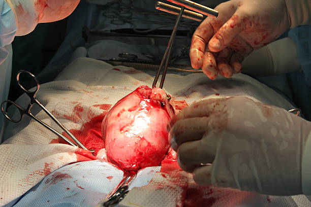 Surgery. Cancer ill women operation stock photo