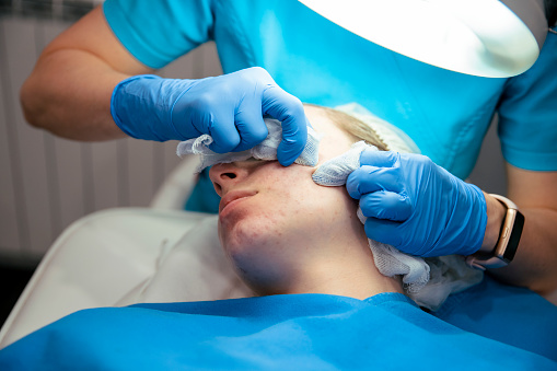 Cleaning teen female face from blackheads and pimples. Teenage Woman at Acne treatment in dermatology professional clinic. Close up